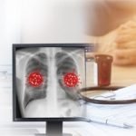 quality assurance in diagnostic radiology
